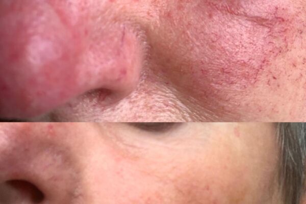 WhatsApp Image 2025-02-13 at 10.43.11_6a6b035a