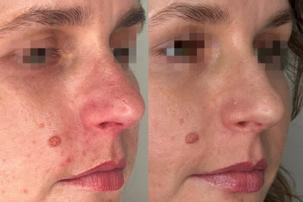 WhatsApp Image 2025-02-13 at 10.43.36_e444e92a