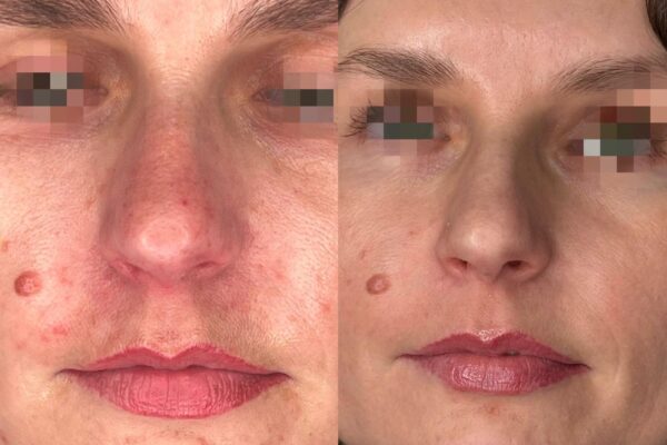 WhatsApp Image 2025-02-13 at 10.43.36_e89bfebd