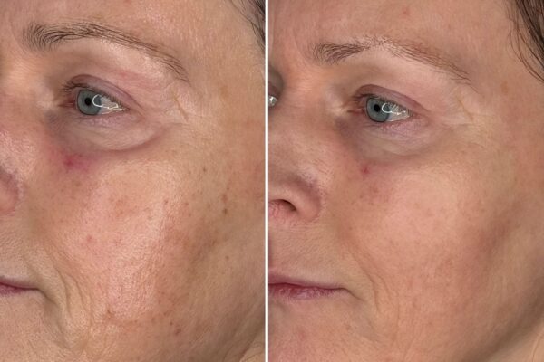 WhatsApp Image 2025-02-13 at 11.01.56_e1db797b