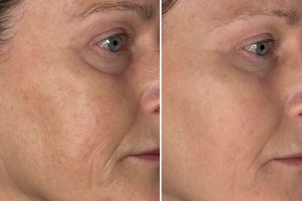 WhatsApp Image 2025-02-13 at 11.01.56_e9732bed